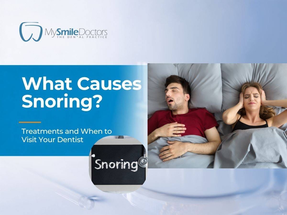 What causes snoring? Man snoring in bed while partner struggles to sleep.