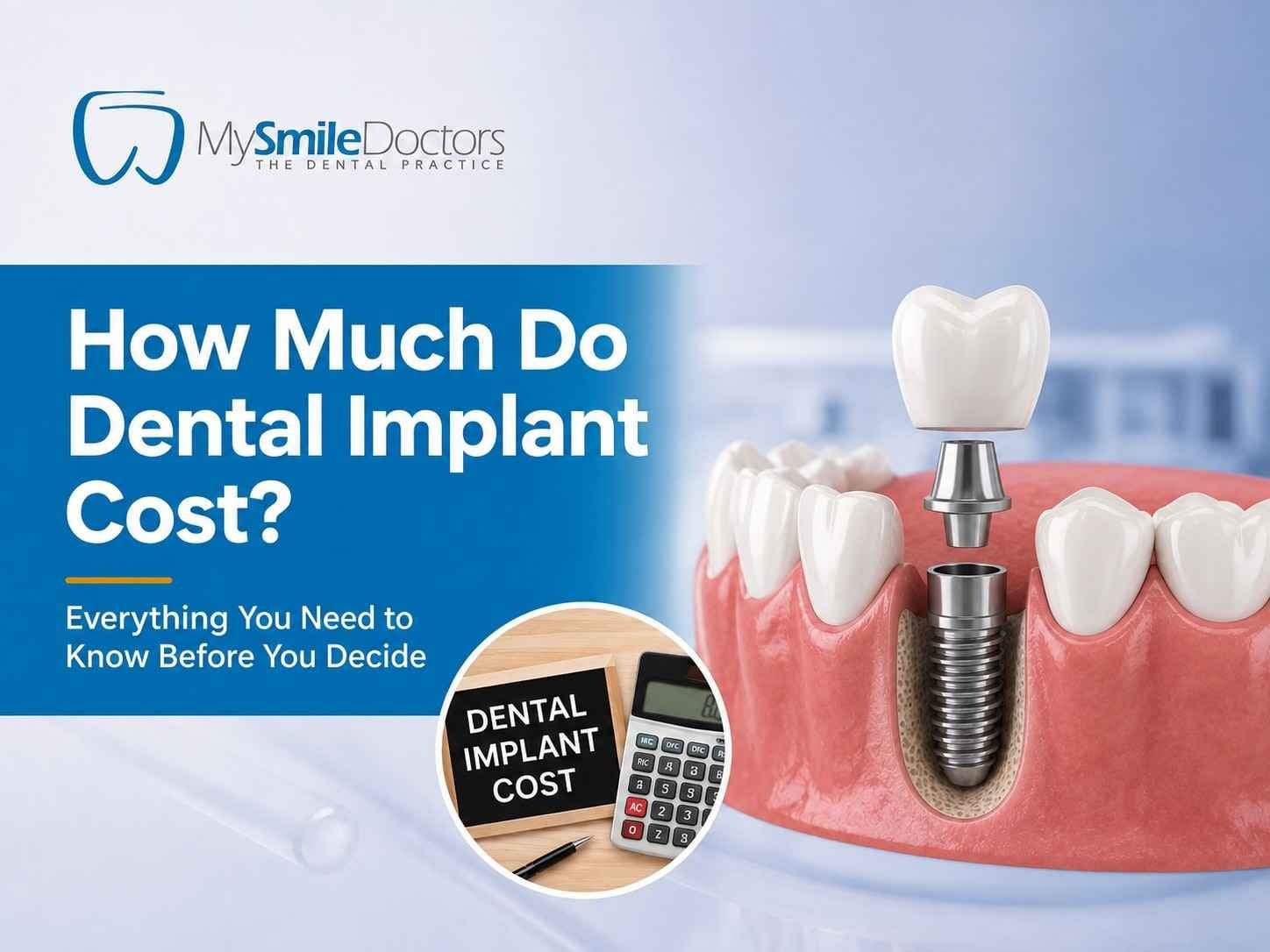 How Much Do Dental Implant Cost