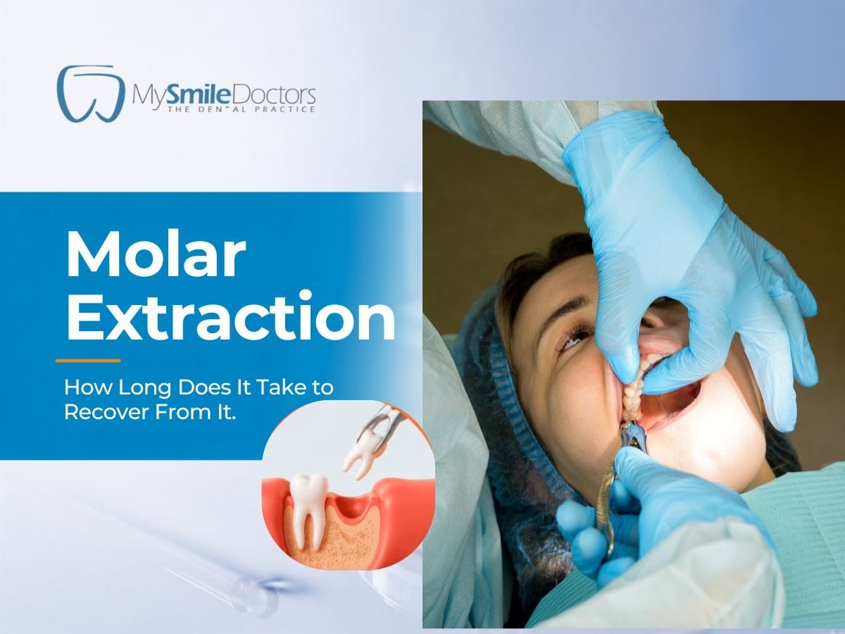 Molar Extraction